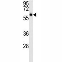 Anti-AKT3, clone 154CT4.5.3