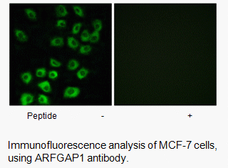 Anti-ARFGAP1