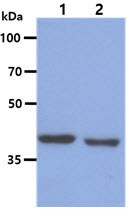 Anti-BCAT1, clone 3C8