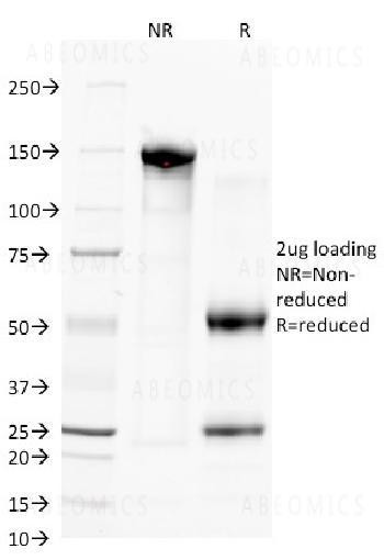 Anti-CD38 (ADP Ribosyl Cyclase 1) Monoclonal Antibody (Clone: FS02)