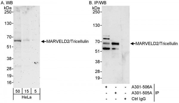 Anti-MARVELD2/Tricellulin