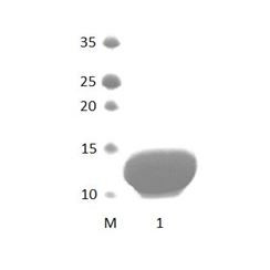 PARD3B_2 PDZ Domain