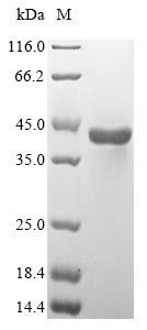Aspartoacylase (ASPA), human, recombinant