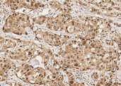 Anti-Mcl-1 Monoclonal Antibody