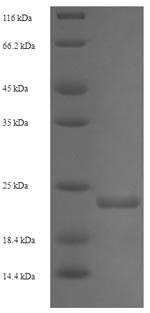 Shiga-like toxin 2 subunit B (stxB2), Enterobacteria phage 933W, recombinant