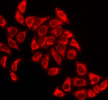 Anti-Pyruvate Dehydrogenase E2
