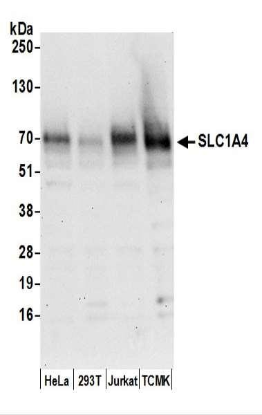 Anti-SLC1A4/ASCT1