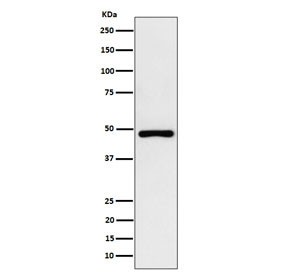 Anti-PAH / Phenylalanine hydroxylase (recombinant antibody), clone 29P62