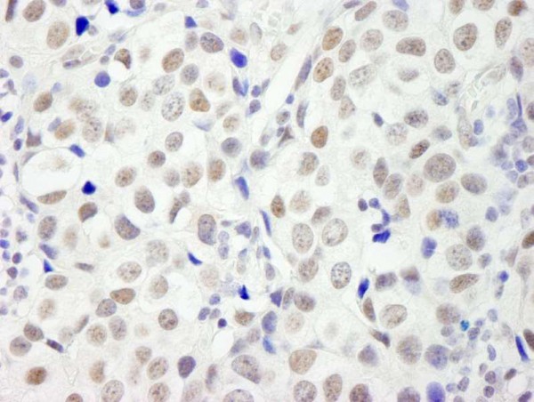 Anti-DFF45/DFFA (IHC)