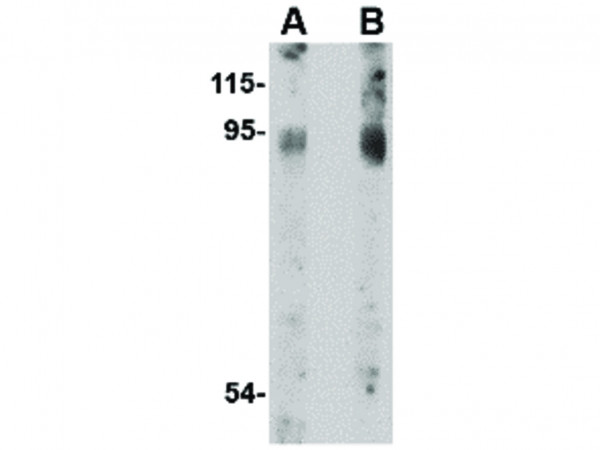 Anti-BICD2