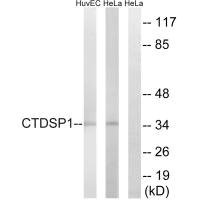 Anti-CTDSP1