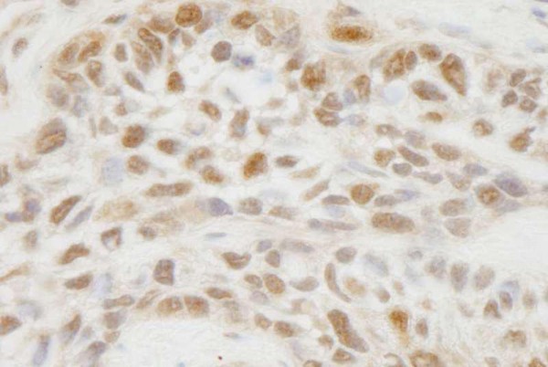 Anti-JMJD1C (IHC)