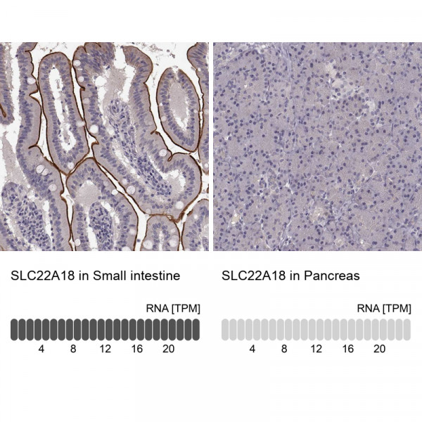 Anti-SLC22A18