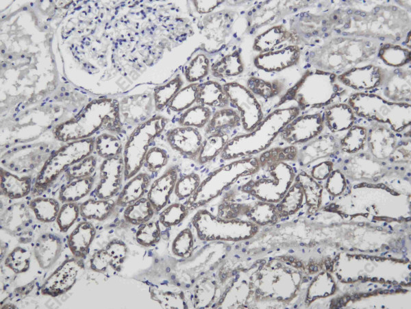 Anti-Recombinant RARbeta, clone C312589