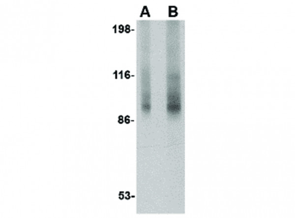 Anti-TNPO3
