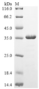 Myosin regulatory light chain 12A (MYL12A), human, recombinant
