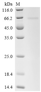 N-myc proto-oncogene protein (MYCN), human, recombinant