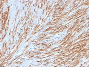 Anti-Calponin-1, clone CNN1/4227R