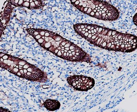 Anti-EpCAM, clone SQab18103