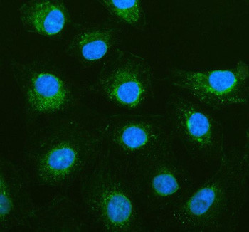 Anti-PGAM5 / Phosphoglycerate mutase family member 5