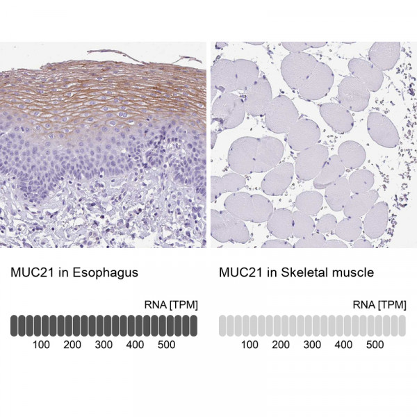 Anti-MUC21