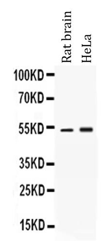 Anti-alpha 1 Antitrypsin