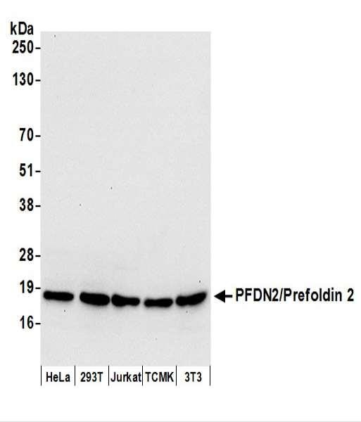 Anti-PFDN2/Prefoldin 2