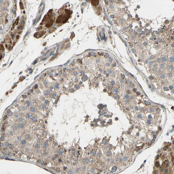 Anti-CFAP61