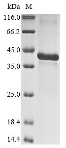 Insulin-like growth factor-binding protein 5 (IGFBP5), human, recombinant