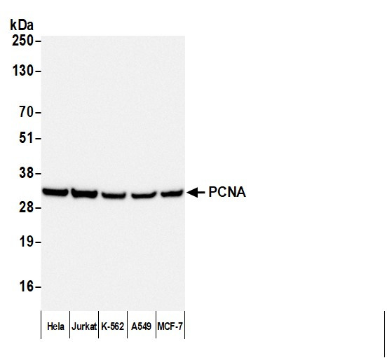 Anti-Mouse IgG-heavy and light chain, HRP conjugated