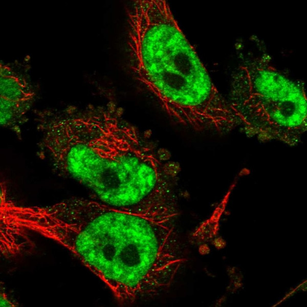 Anti-CD2BP2