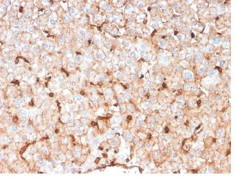 Anti-Apolipoprotein D / APO-D, clone APOD/3414