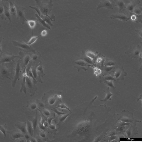 HeLa Cells