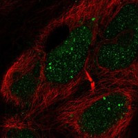 Anti-EBF2