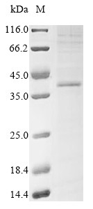 P2Y purinoceptor 12 (P2RY12), human, recombinant