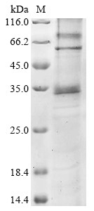 Proteinase-activated receptor 3 (F2RL2), human, recombinant