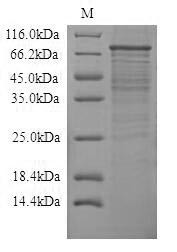 Toll-like receptor 4 (Tlr4), partial, rat, recombinant
