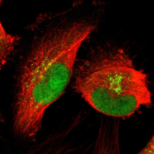 Anti-PRDM2