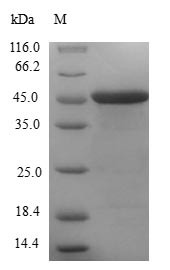 Centrin-1 (CETN1), human, recombinant
