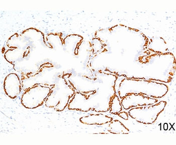 Anti-Cytokeratin 14, clone LL002