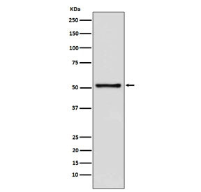 Anti-TdT, clone AFHA-4