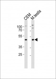 Anti-Lhx1