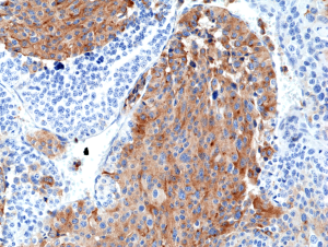 Anti-Chromogranin A (human), Rabbit Monoclonal (RM385)