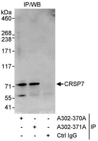 Anti-CRSP7