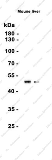Anti-Recombinant ASS1, clone C112666