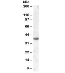 Anti-ERCC1