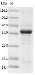 CMRF35-like molecule 1 (Cd300lf), partial, rat, recombinant