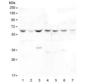 Anti-DOK7 / Docking protein 7