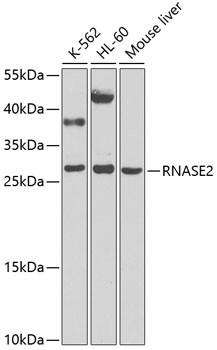 Anti-RNASE2