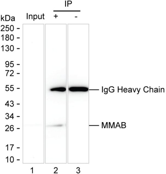 Anti-MMAB